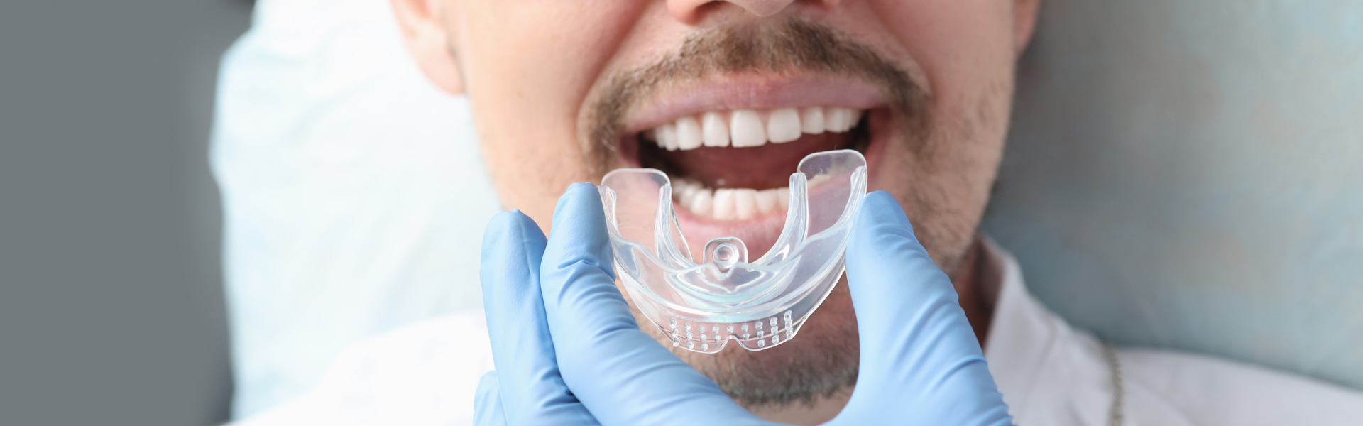Mouthguards in Modesto